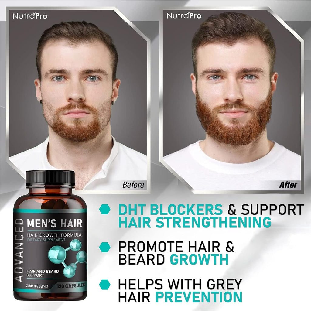 Hair Growth Vitamins for Men, Anti Hair Loss Pills with Biotin and Saw Palmetto U2278