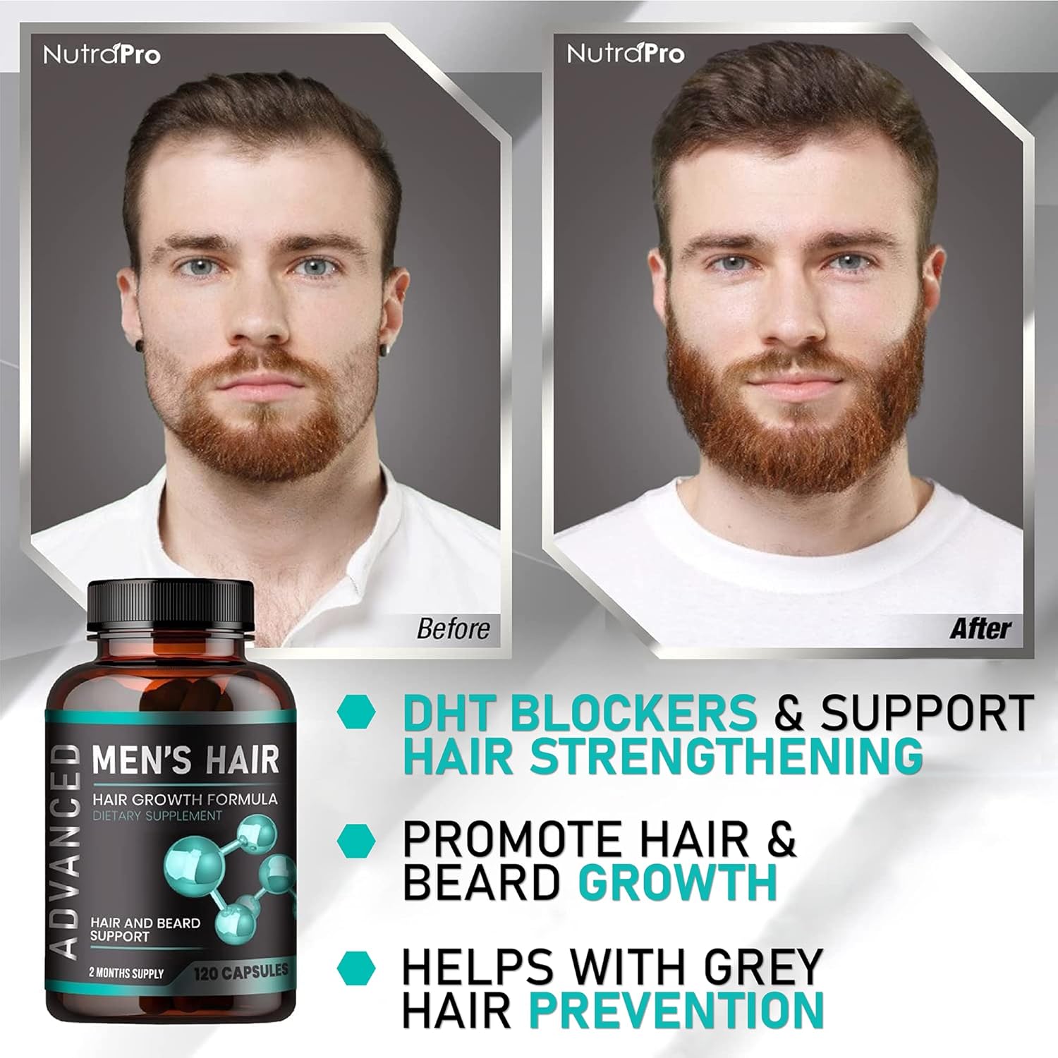 Hair Growth Vitamins for Men, Anti Hair Loss Pills with Biotin and Saw Palmetto U2278